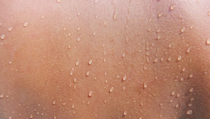 Close-up of skin with visible sweat droplets highlighting how stress affects the body